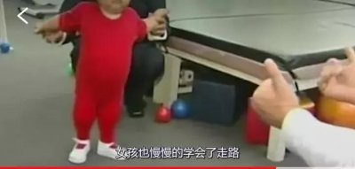 ​女子生下“美人鱼宝宝”，医生10年手术终于帮她割去“鱼尾”