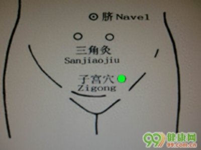 子宫穴穴位的准确位置图 子宫穴作用